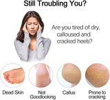 Electric Foot Grinder Vacuum Foot Grinding Machine Exfoliating Dead Skin Callus Remover Foot Care